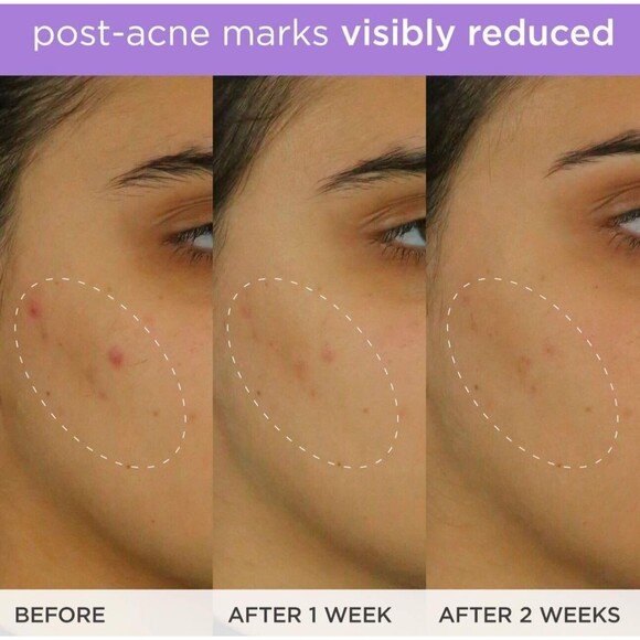 Tatcha The Brightening Serum 1 fl oz / 30 ml NIB - Picture 7 of 8